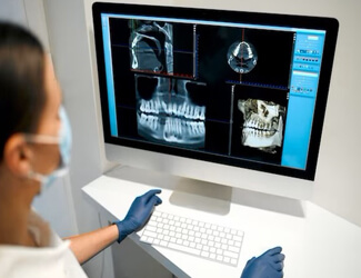 Picture of a female dental assistant reading panoramics in her computer