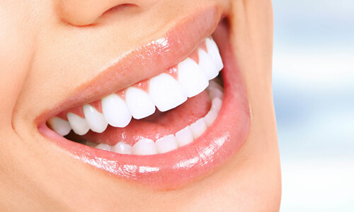 Picture of a woman with perfect teeth after having a dental veneers procedure done at the Costa Rica Dental Center in San Jose, Costa Rica.  The picture is a close-up of a perfect smile.